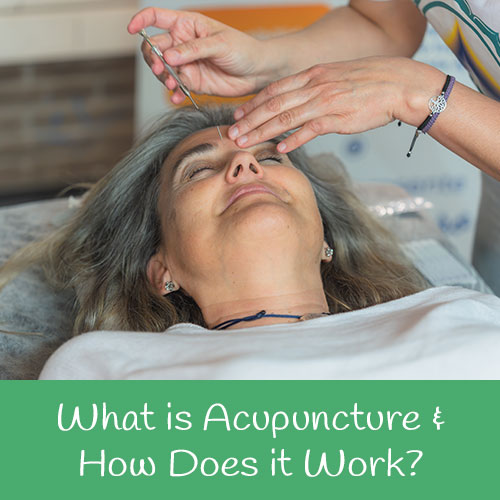 What is Acupuncture and how does it work?