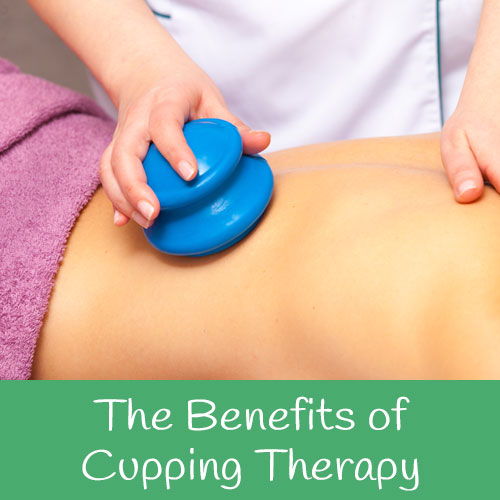 The Benefits of Cupping Therapy
