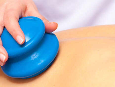 Cupping Therapy for Massage